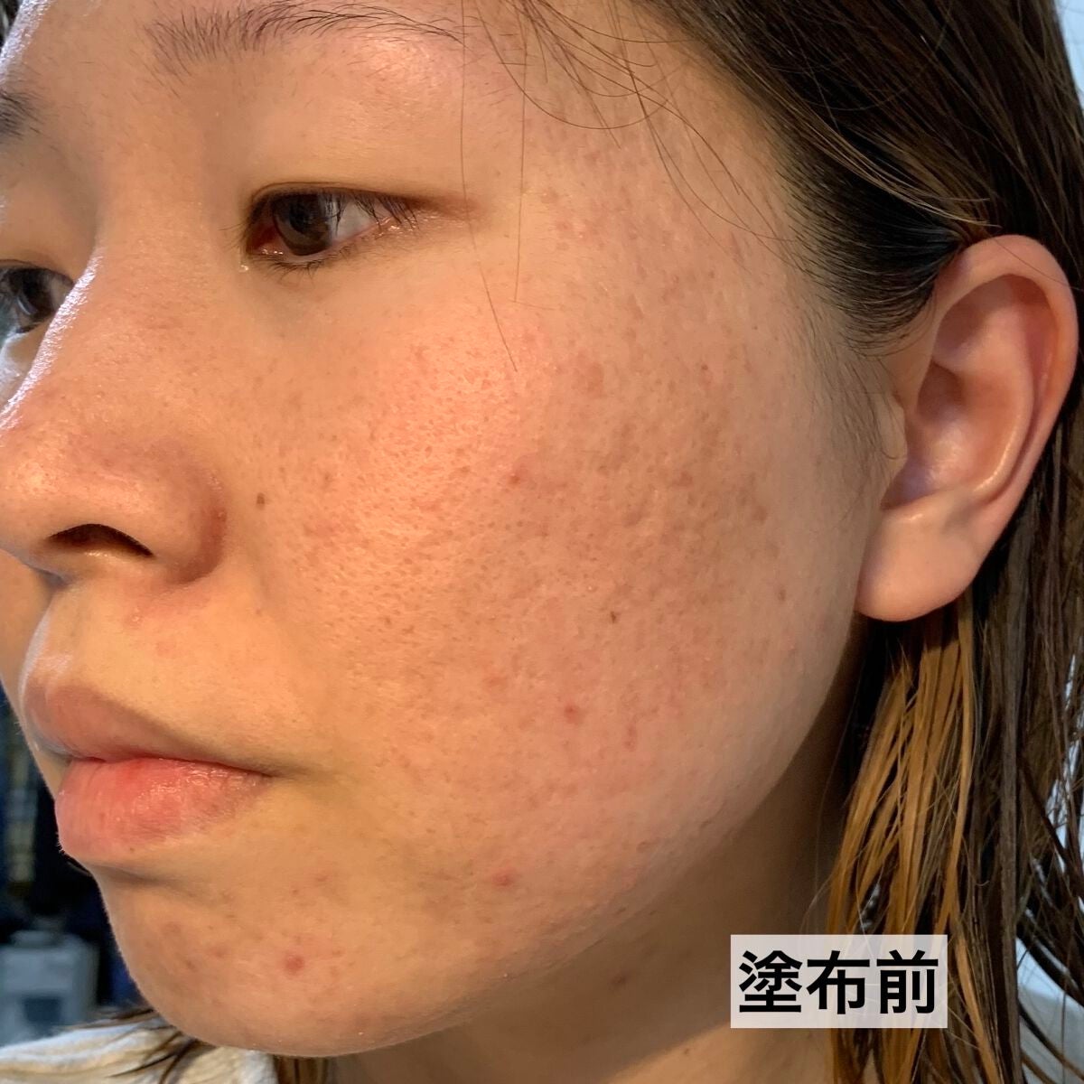 ザ ファーストエッセンス/ALBLANC/美容液を使ったクチコミ(9枚目)