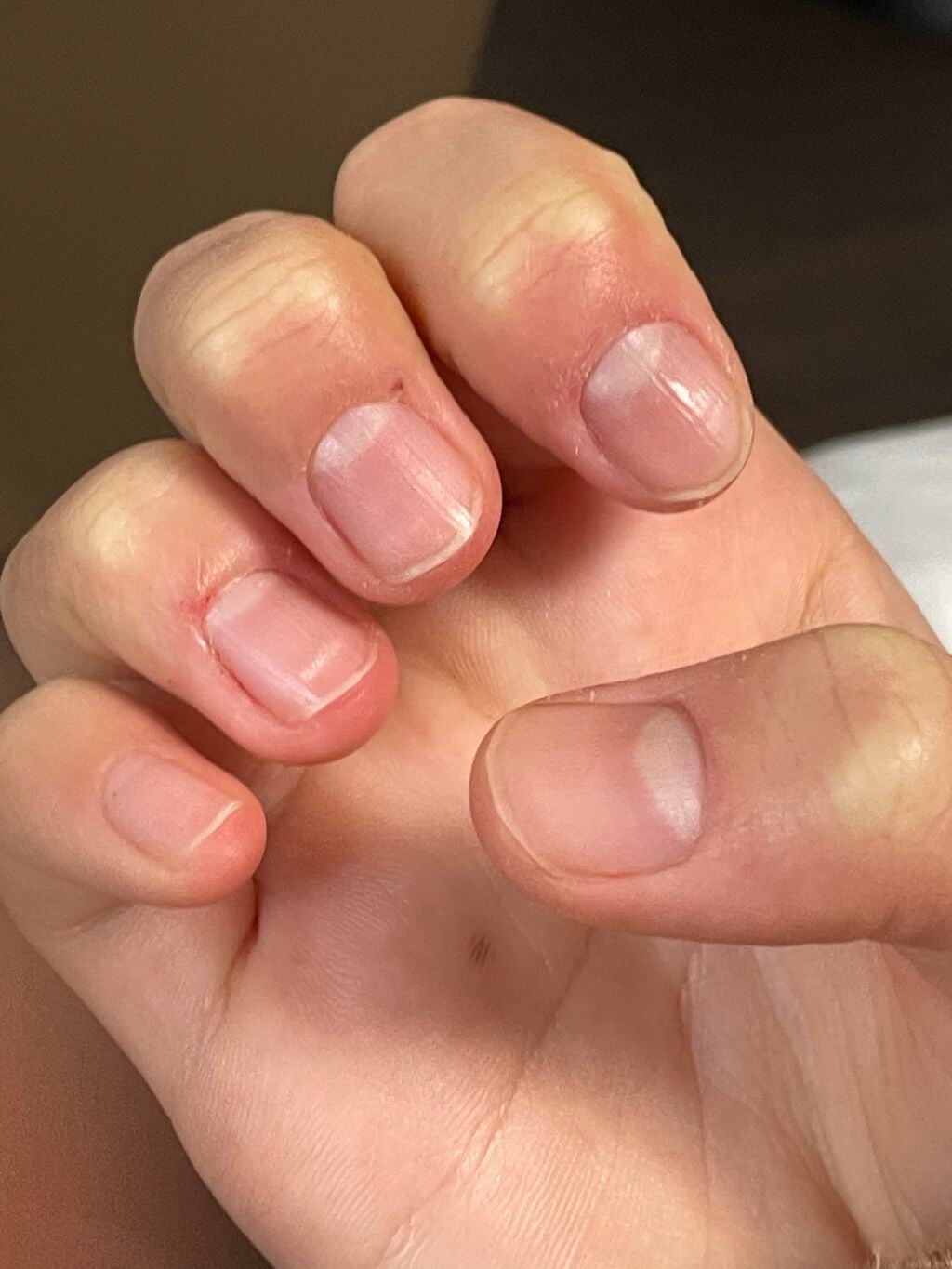 ウィンマックス キューティクルオイル/DAISO/ネイルオイル・トリートメントを使ったクチコミ(7枚目)