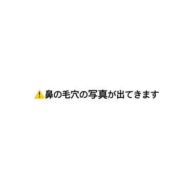 憫(びん) on LIPS 「【たった1000円！　毛穴が気になる方必見‼︎😳】　⚠️bef..」（2枚目）