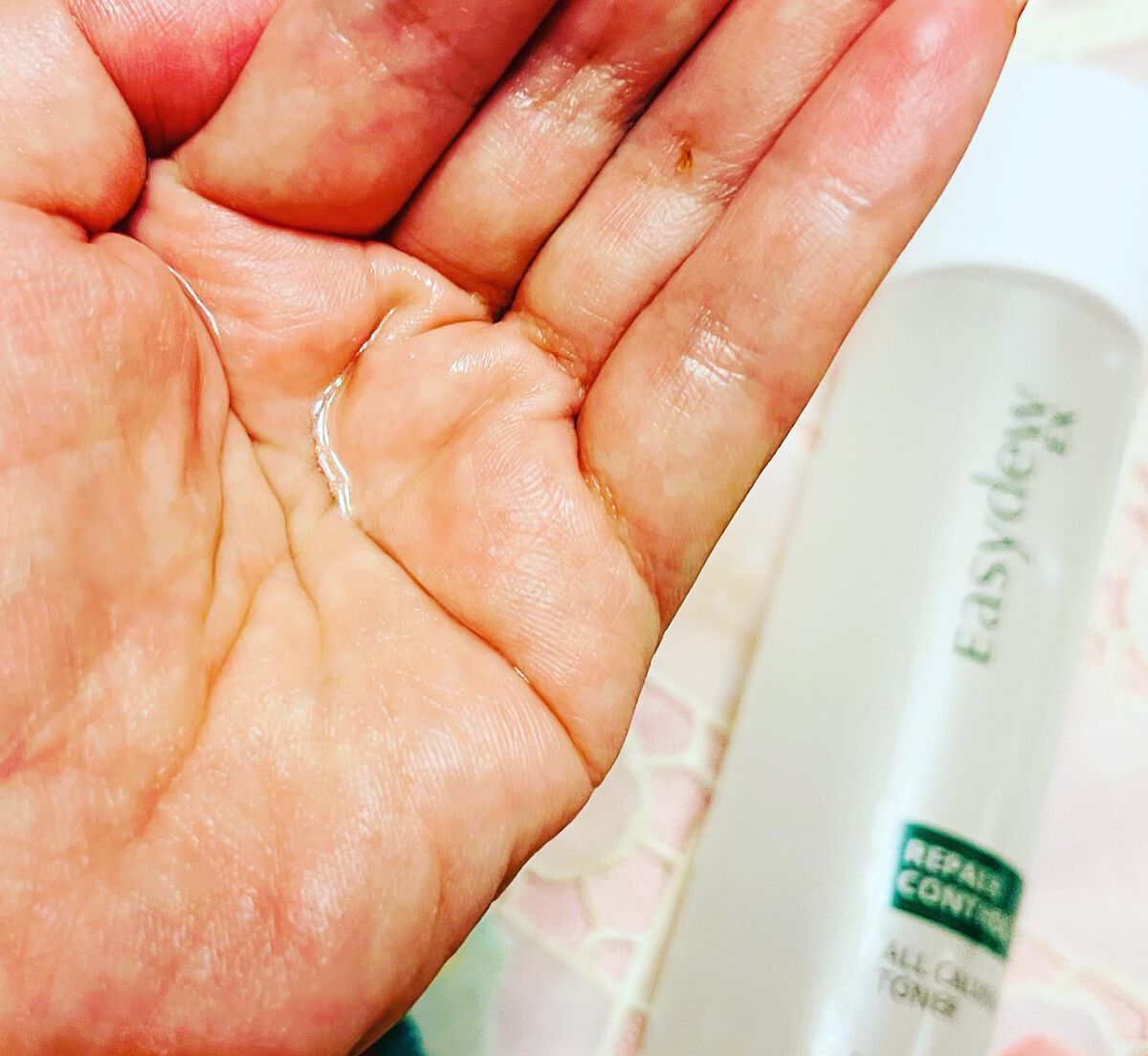 Easydew EX ALL CALMING TONER オール カーミング トナー/Easydew/化粧水を使ったクチコミ（2枚目）