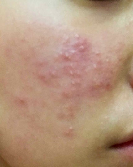 赤箱 (しっとり)/カウブランド/洗顔石鹸を使ったクチコミ(2枚目)