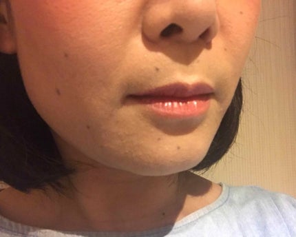 リップ ジェル マジック EX/コーセーコスメニエンス/リップオイルを使ったクチコミ(4枚目)