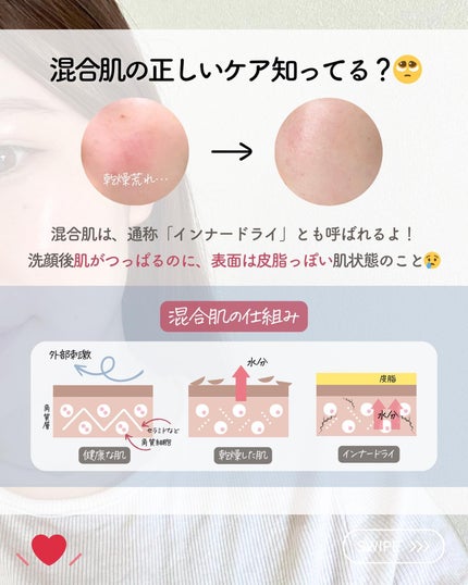 らな ♡ 韓国スキンケア / 韓国コスメ on LIPS 「【混合肌完全保存版❣️スキンケアの選び方🇰🇷】今日は混合肌さん..」(2枚目)