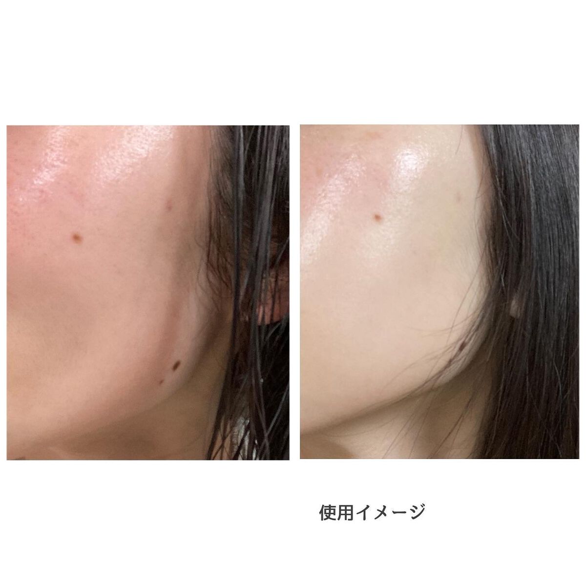 シカレチA エッセンス0.1/VT/美容液を使ったクチコミ(4枚目)