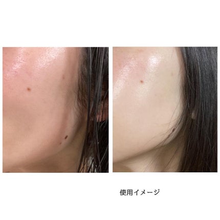 シカレチA エッセンス0.1/VT/美容液を使ったクチコミ(4枚目)