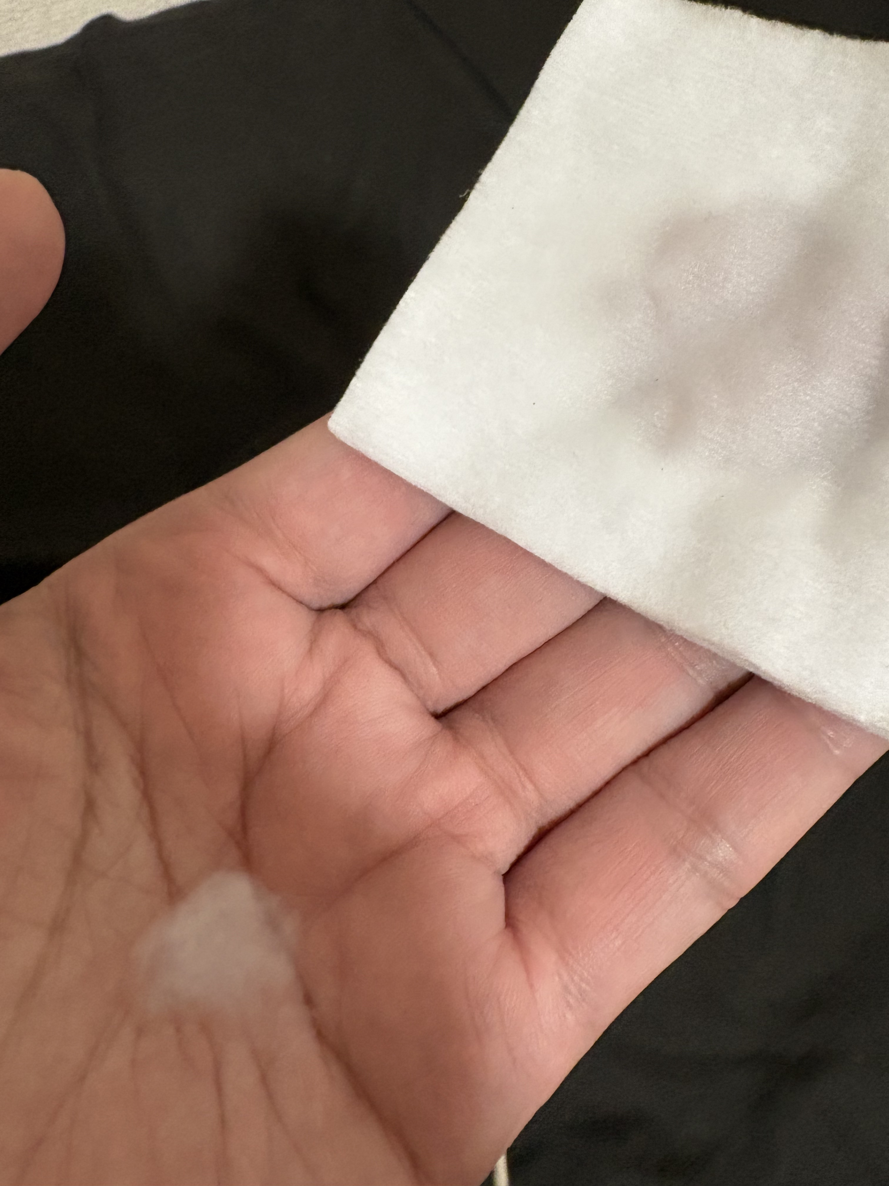 パラビオ ACローション/パラビオ/化粧水を使ったクチコミ（2枚目）