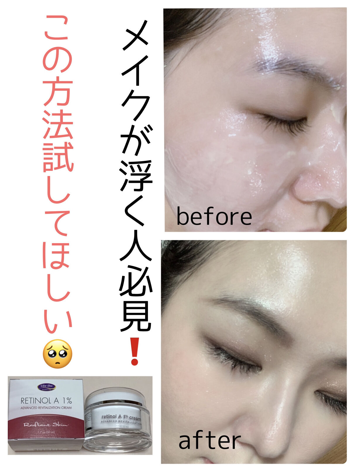 レチノールA 1% アドバンスドリバイタリゼーションクリーム/Life-flo/フェイスクリームを使ったクチコミ（1枚目）