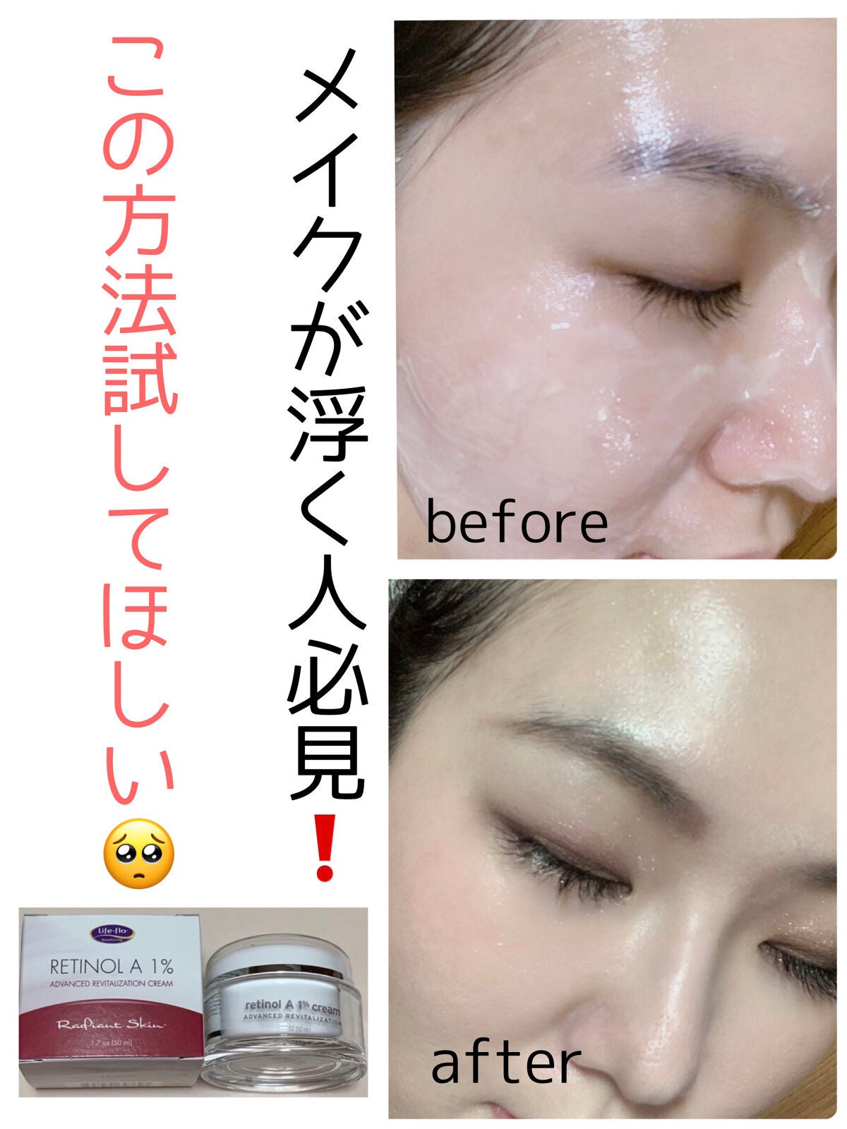 レチノールA 1% アドバンスドリバイタリゼーションクリーム/Life-flo/フェイスクリームを使ったクチコミ(1枚目)