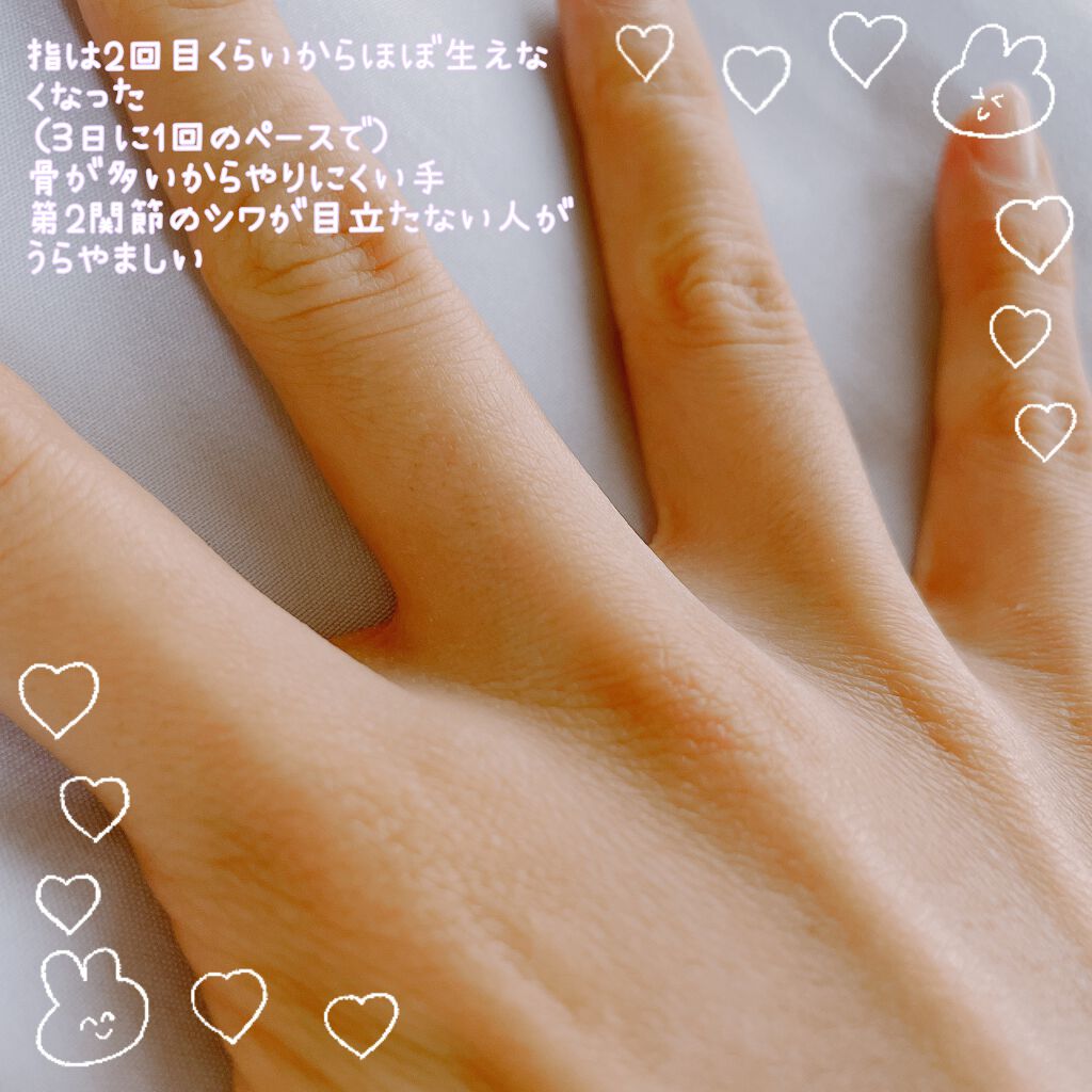 FASIZ607C IPL光脱毛器/FASIZ/家庭用脱毛器を使ったクチコミ（2枚目）