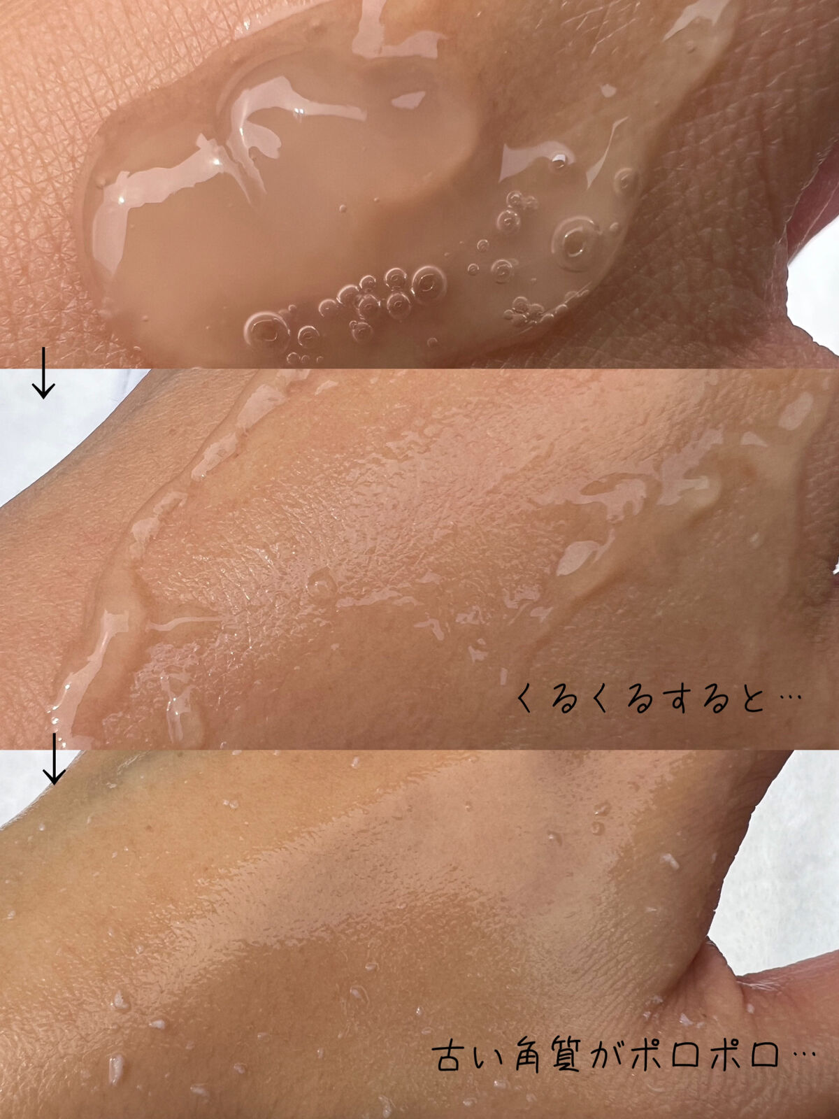 美白乃美人ピーリングジェル/ブレーンコスモス/ピーリングを使ったクチコミ（2枚目）