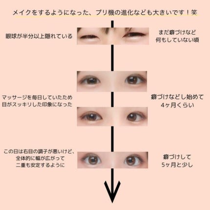 アイテープ(絆創膏タイプ、レギュラー、70枚)/DAISO/二重まぶた用アイテムを使ったクチコミ(2枚目)