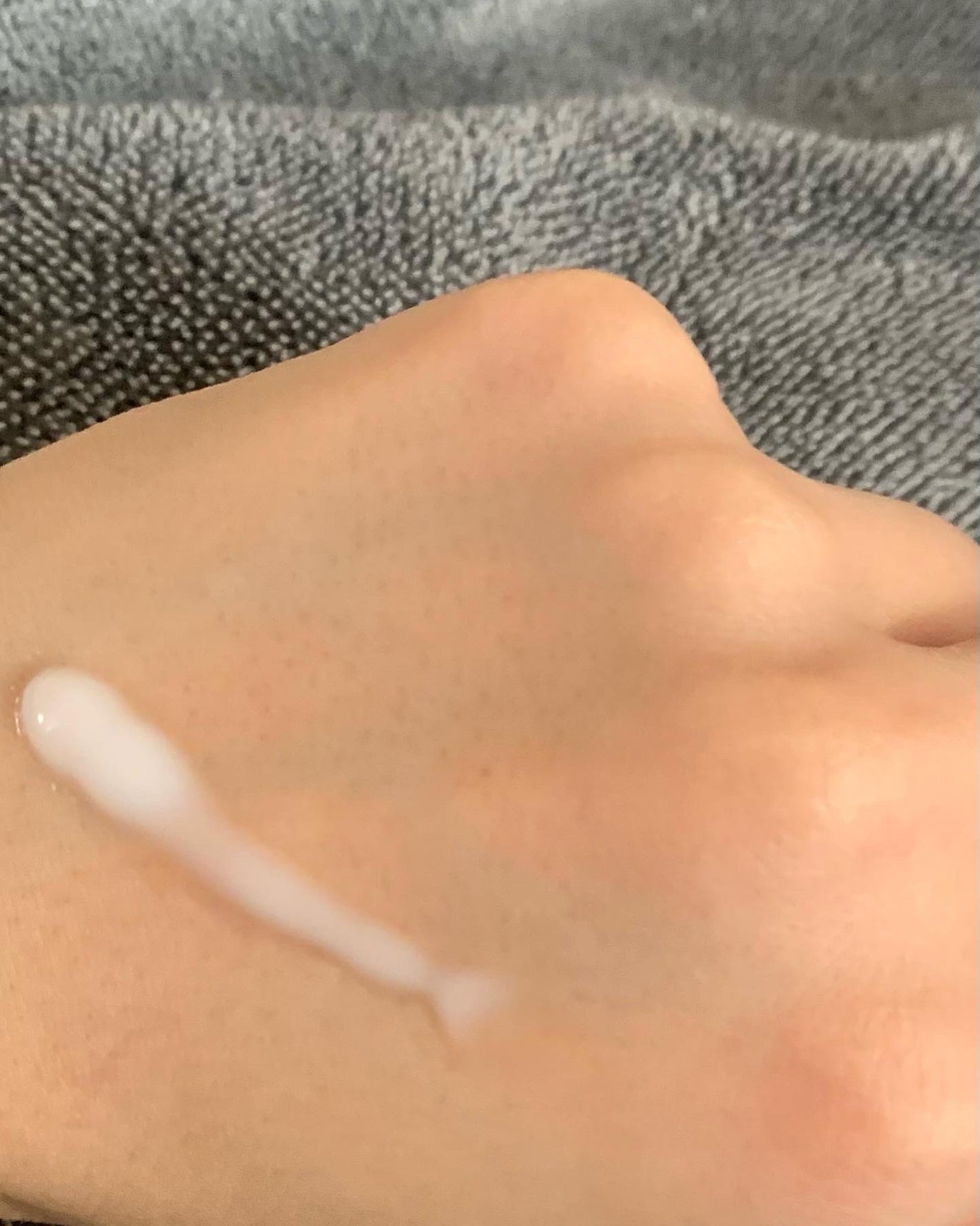 薬用CICAクリーム/アクネスラボ/フェイスクリームを使ったクチコミ(2枚目)