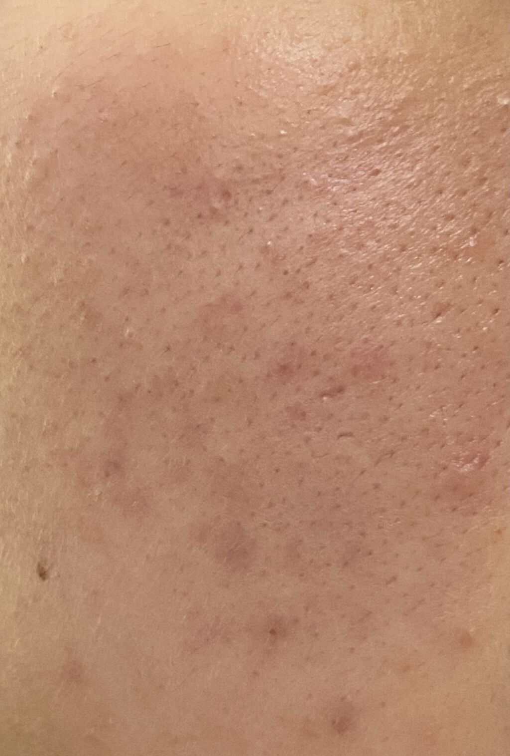 ハトムギ化粧水(ナチュリエ スキンコンディショナー R )/ナチュリエ/化粧水を使ったクチコミ（1枚目）