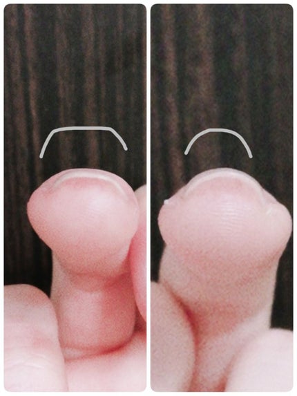 ジェルボリュームトップコート/キャンメイク/ネイルトップコートを使ったクチコミ(5枚目)