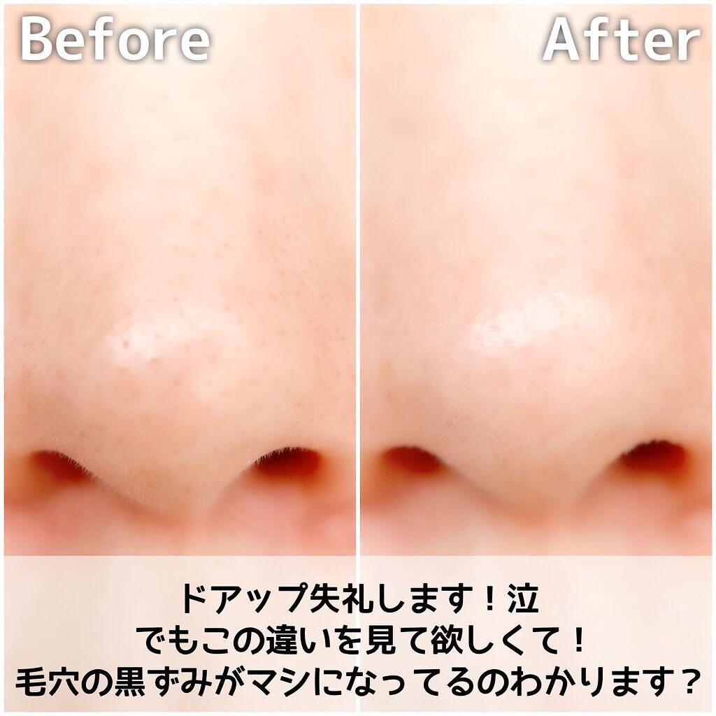 ソフィーナ iP ポア クリアリング ジェル ウォッシュ/SOFINA iP/その他洗顔料を使ったクチコミ(6枚目)