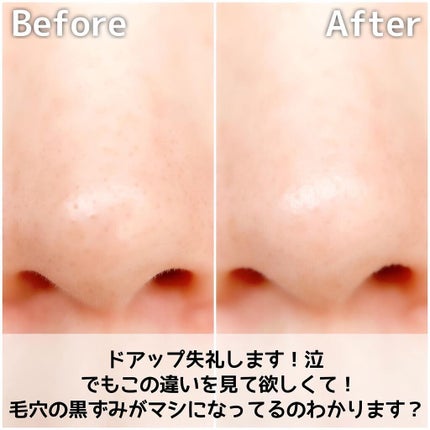 ソフィーナ iP ポア クリアリング ジェル ウォッシュ/SOFINA iP/その他洗顔料を使ったクチコミ(6枚目)