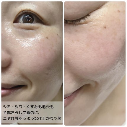 ダイブイン セラム/Torriden/美容液を使ったクチコミ(5枚目)