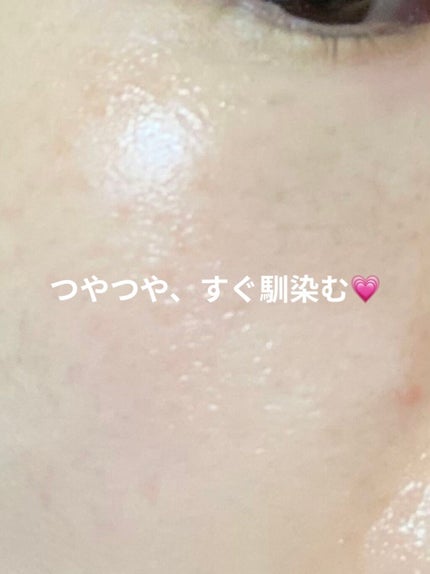 薬用ホワイトニングクリアローションEX/トランシーノ/化粧水を使ったクチコミ(4枚目)