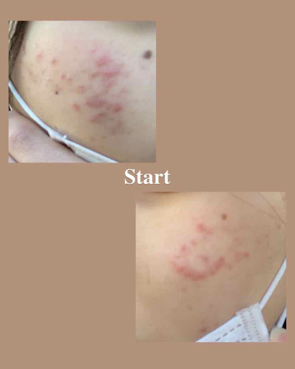 ðŠ on LIPS ãã¹ãã³ã±ã¢æ¹æ³ææŽé¡b.glenã¯ã¬ã€ãŠã©ãã·ã¥åç²§æ°Žteat..ãïŒ2æç®ïŒ