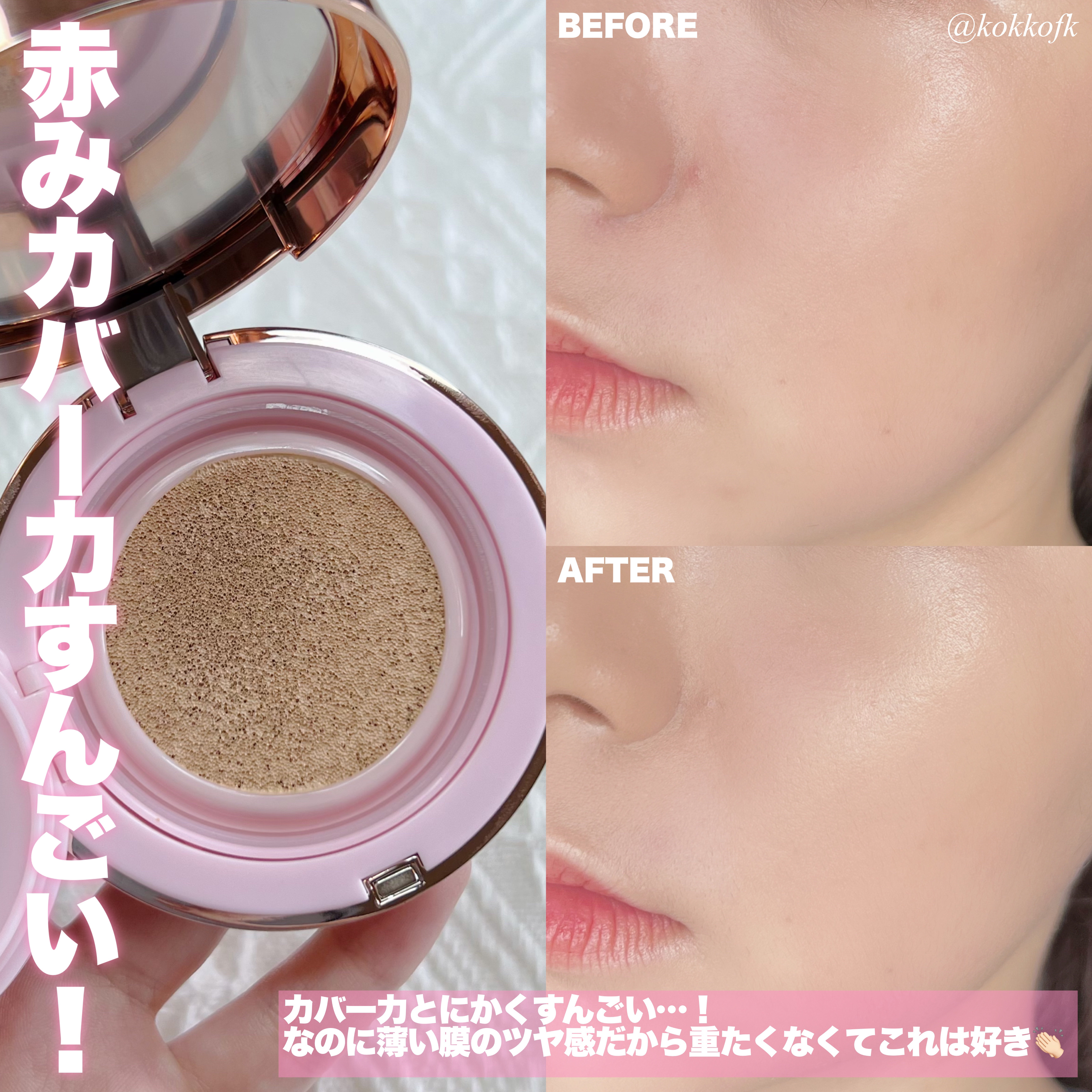 ピンクティーツリーカバーアップグロウクッション/APLIN/クッションファンデーションを使ったクチコミ（3枚目）