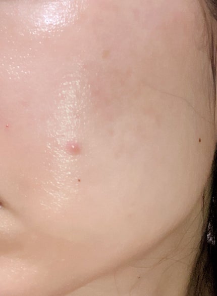 モイスチュア リポソーム/DECORTÉ/美容液を使ったクチコミ(2枚目)