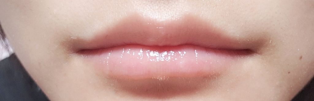 モアリップ N (医薬品)/資生堂薬品/その他を使ったクチコミ（3枚目）