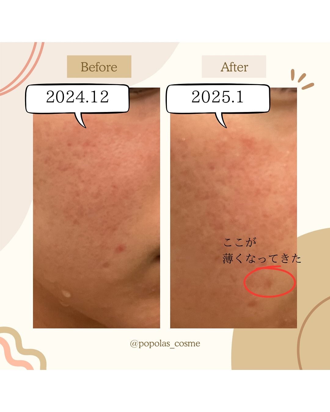 肌をうるおす保湿クリーム/肌をうるおす保湿スキンケア/フェイスクリームを使ったクチコミ(9枚目)