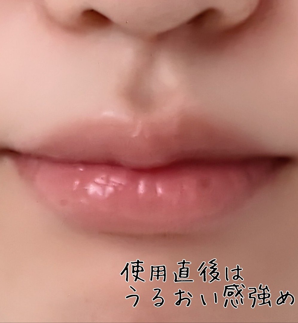 アップルリップオイル/NOONI/リップグロスを使ったクチコミ（2枚目）