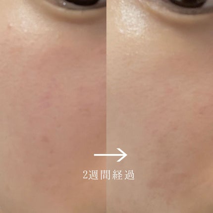 バイオ コンディショニング エッセンス/IOPE/ブースター・導入液を使ったクチコミ(4枚目)