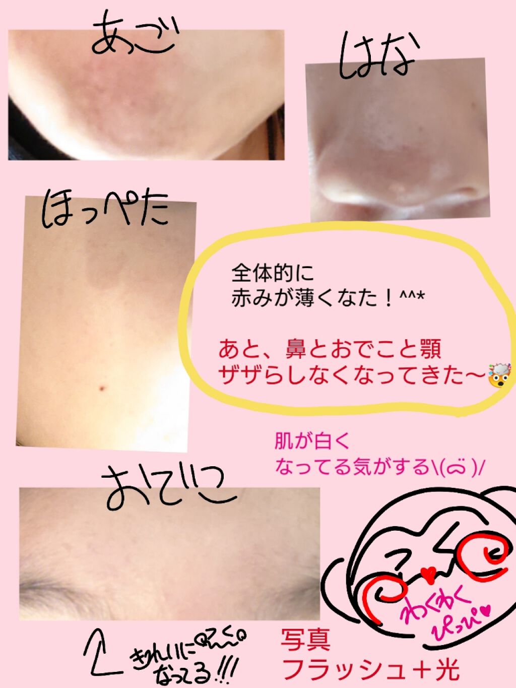 ハトムギ保湿ジェル(ナチュリエ スキンコンディショニングジェル)/ナチュリエ/美容液を使ったクチコミ（2枚目）