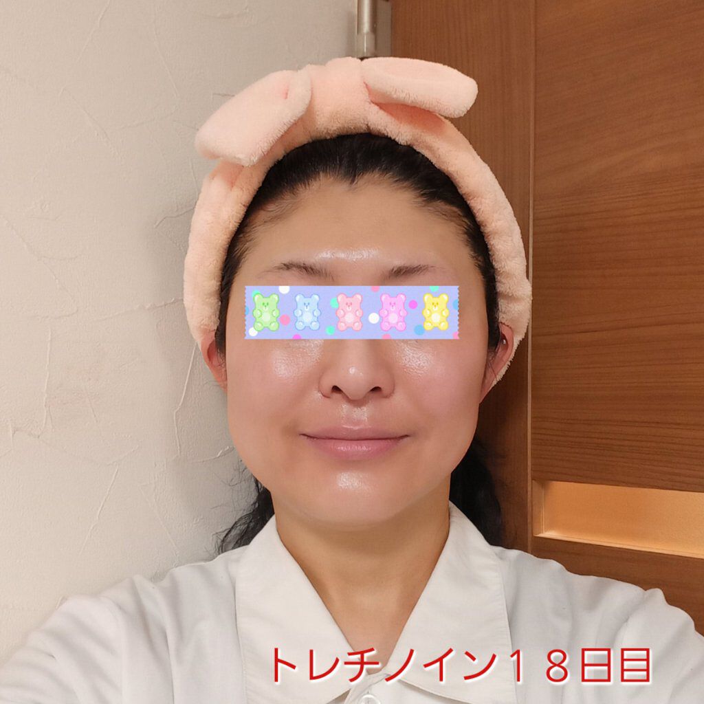 リンクルシートマスク Ｎ/なめらか本舗/シートマスク・パックを使ったクチコミ（1枚目）