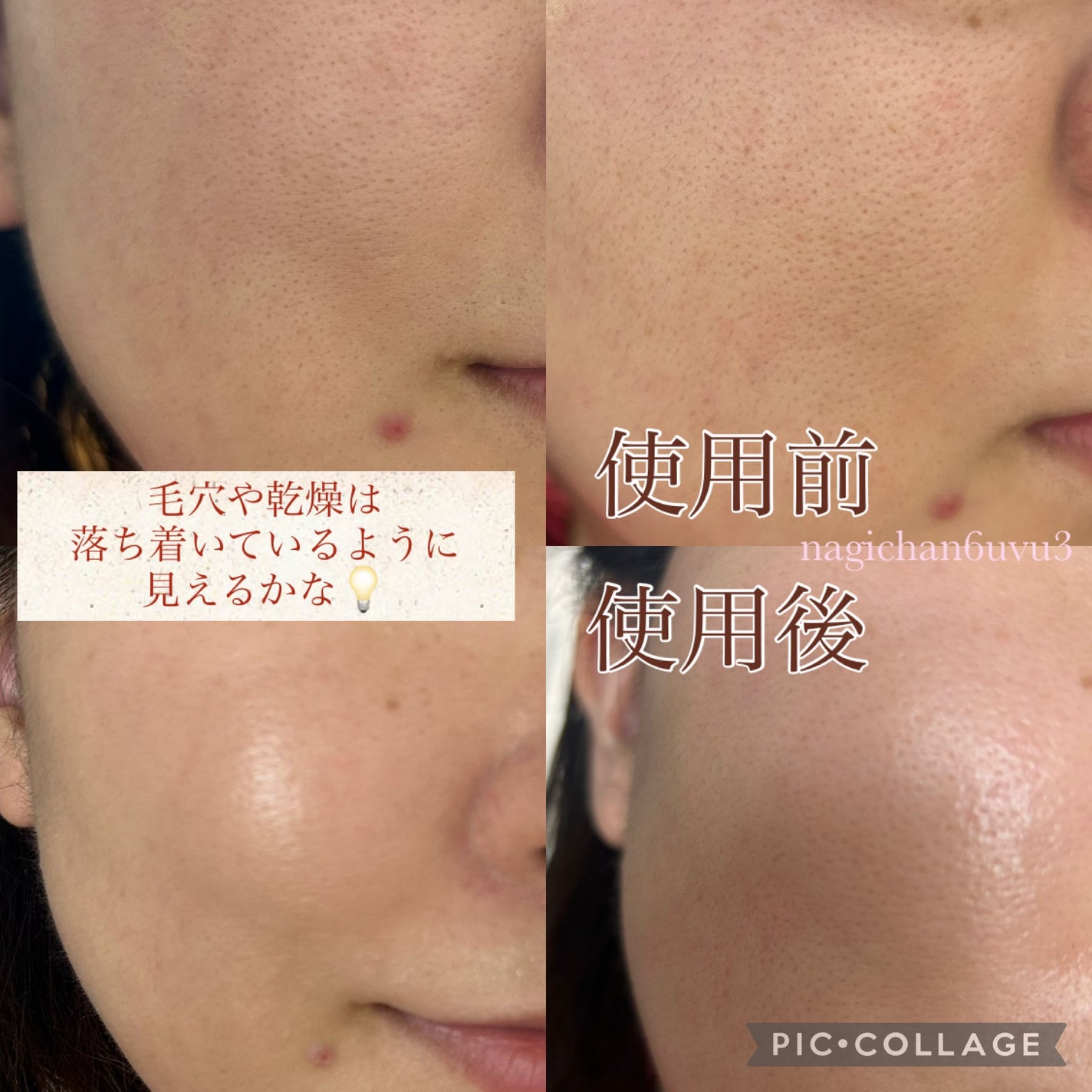 薬用クリアエステヴェール/Macchia Label/リキッドファンデーションを使ったクチコミ(3枚目)