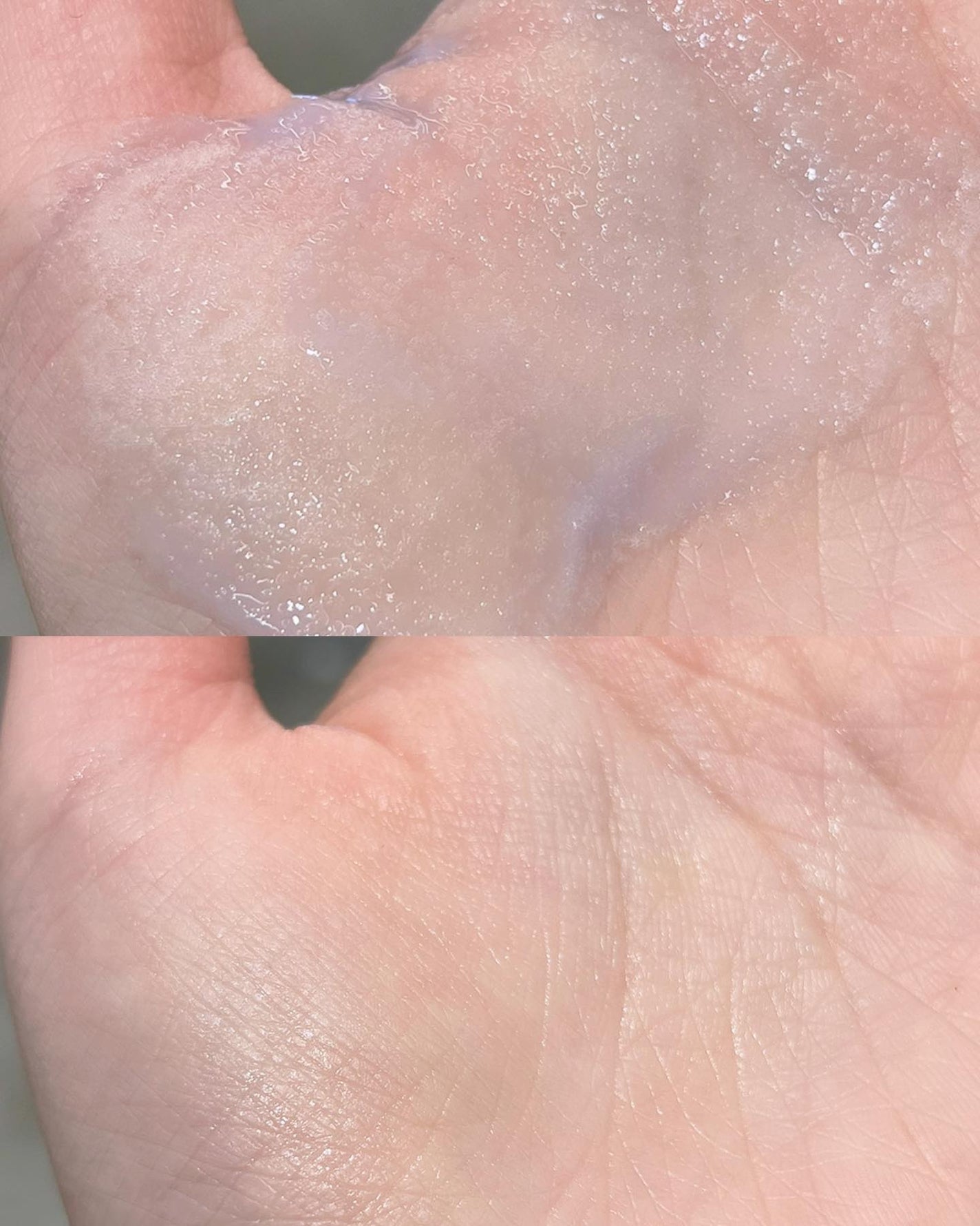 ペプチド ボリューム マスター エッセンス/DR.PEPTI/美容液を使ったクチコミ(5枚目)