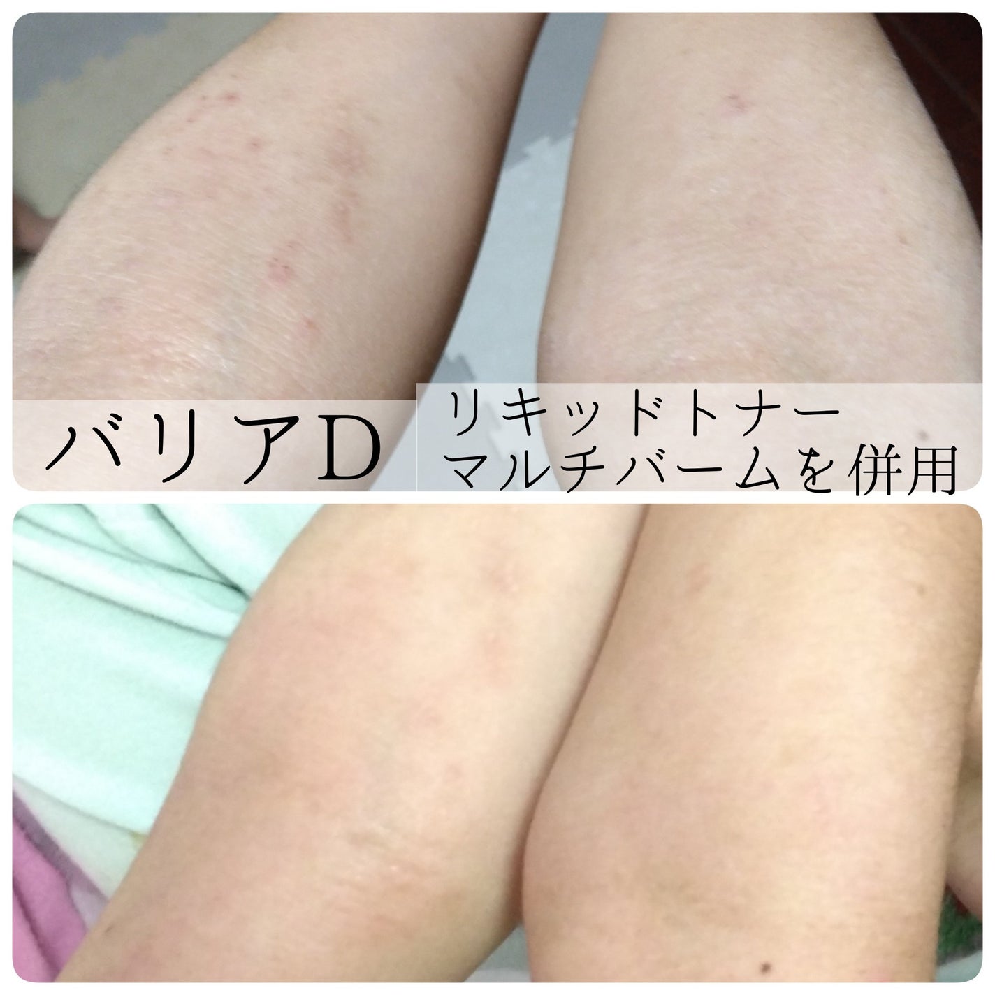 ザモイスチャーバリアDリキッドトナー/Dr.G/化粧水を使ったクチコミ(4枚目)