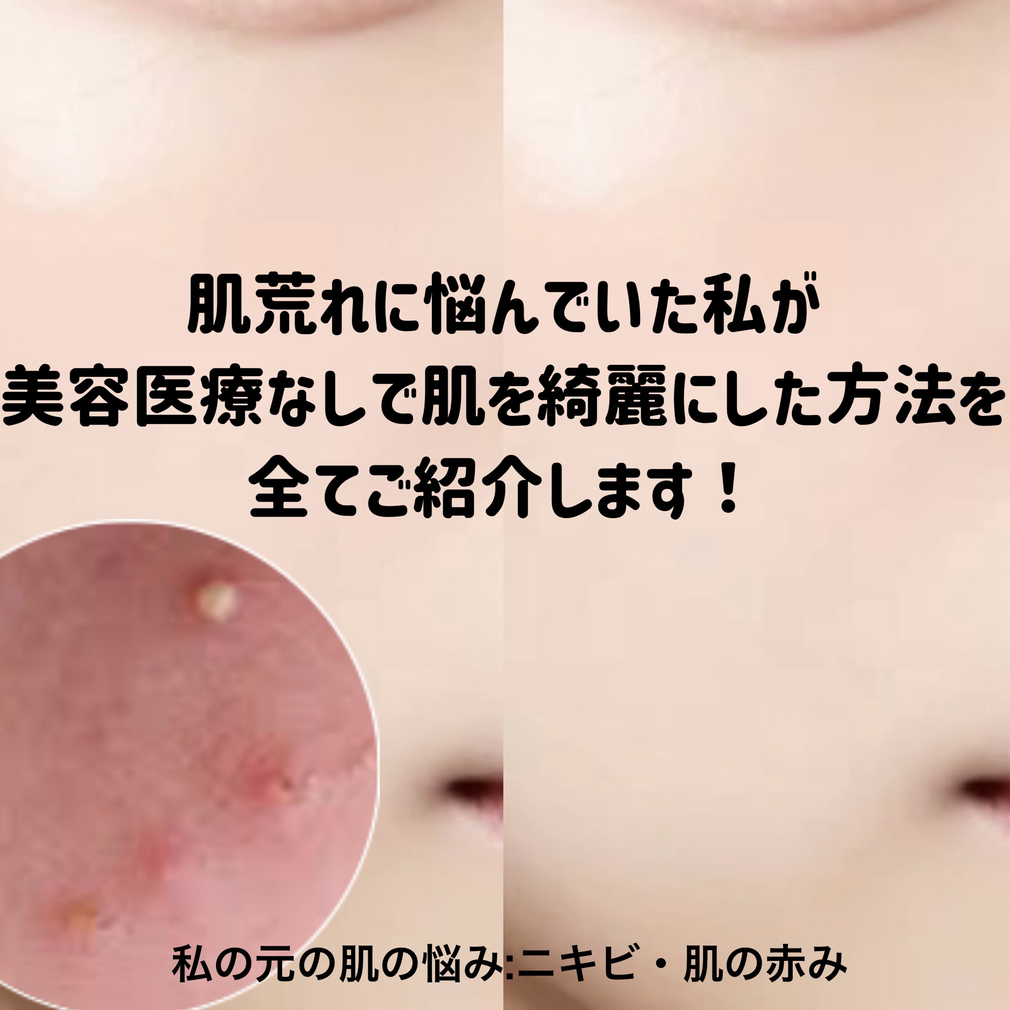 ITOクレンジングタオル/ITO/クレンジングタオルを使ったクチコミ（2枚目）