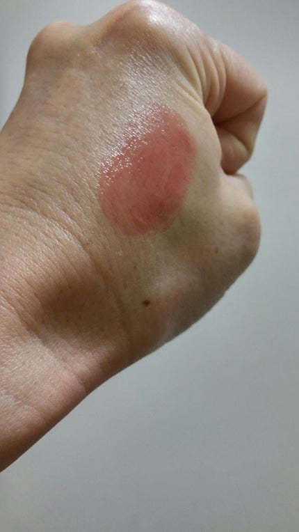 オペラ リップティント N/OPERA/リップティントを使ったクチコミ(2枚目)