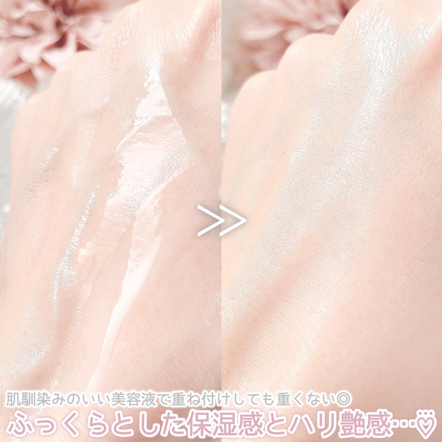 バクチオールスーパーバイオーム リフティングアンプル/VELY VELY/美容液を使ったクチコミ(5枚目)