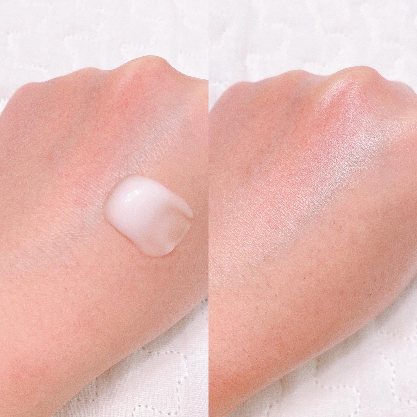 レッドブレミッシュ クリアスージングクリーム/Dr.G/フェイスクリームを使ったクチコミ(3枚目)