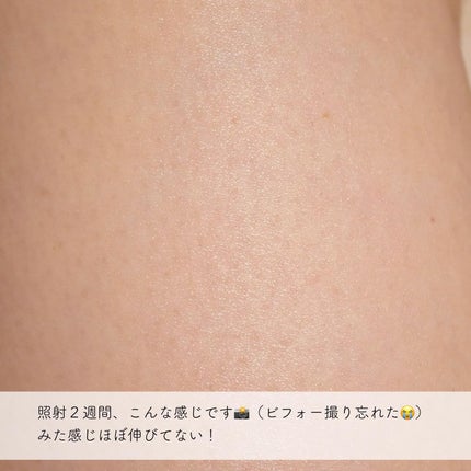 umiushið³ on LIPS ãYA-MANããããããã ããŸããâšææ°ãã€ãã¯ãŒå
çŸå®¹åšð¡ã€..ãïŒ6æç®ïŒ