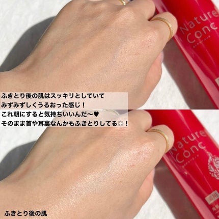 ネイチャーコンク 薬用クリアローション/ネイチャーコンク/拭き取り化粧水を使ったクチコミ(5枚目)
