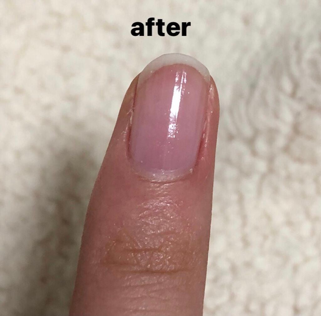 ジェルボリュームトップコート/キャンメイク/ネイルトップコートを使ったクチコミ(3枚目)