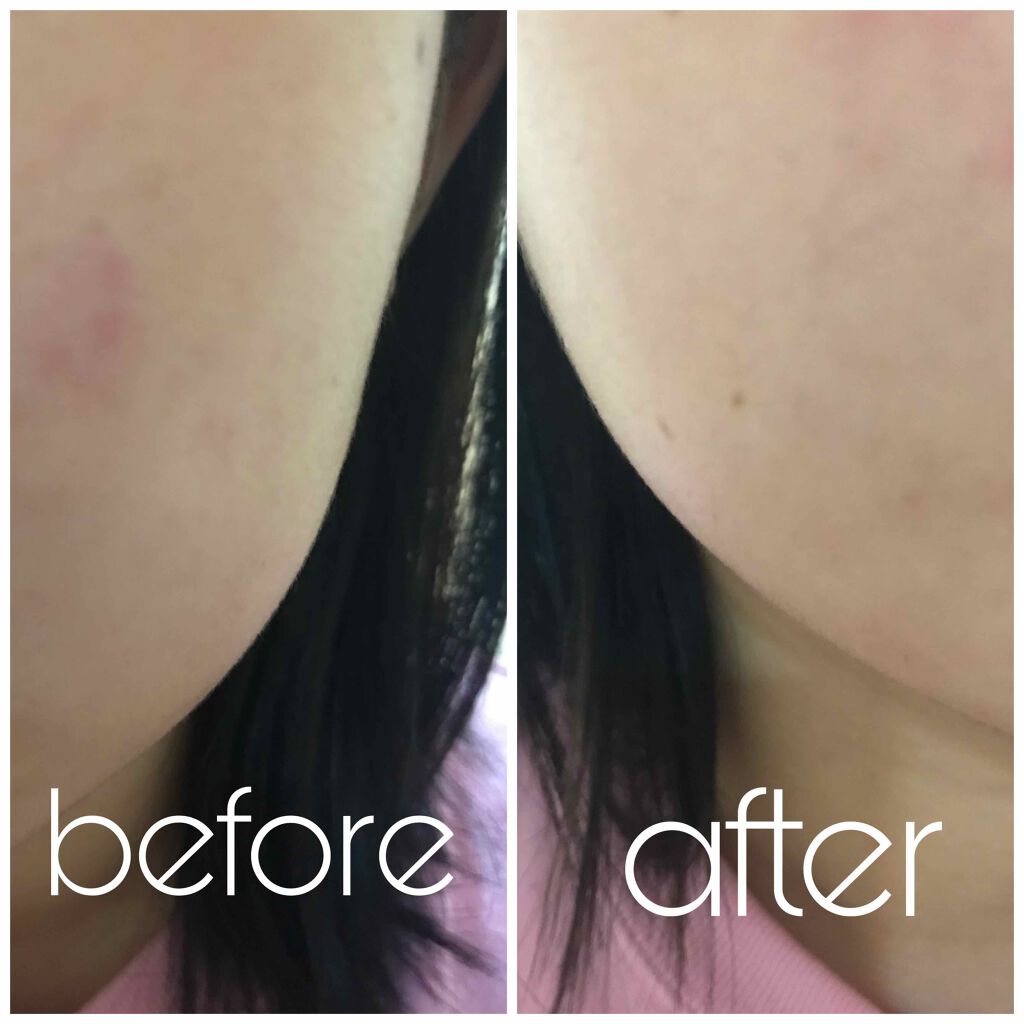 MILK BUBBLE ESSENCE PACK ＃STRAWBERRY/G9SKIN/美容液を使ったクチコミ（3枚目）