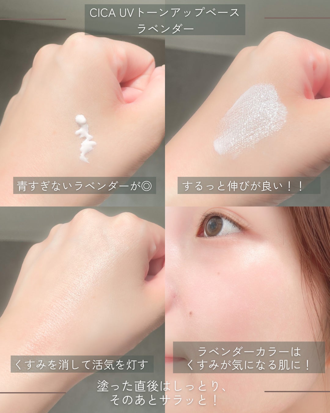 シカレチA クリーム0.05/VT/フェイスクリームを使ったクチコミ(5枚目)