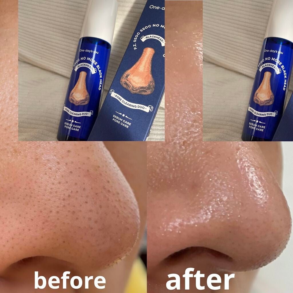 ノーモアブラックヘッド(ノーズピーリング)/One-day's you/スクラブ・ゴマージュを使ったクチコミ(2枚目)