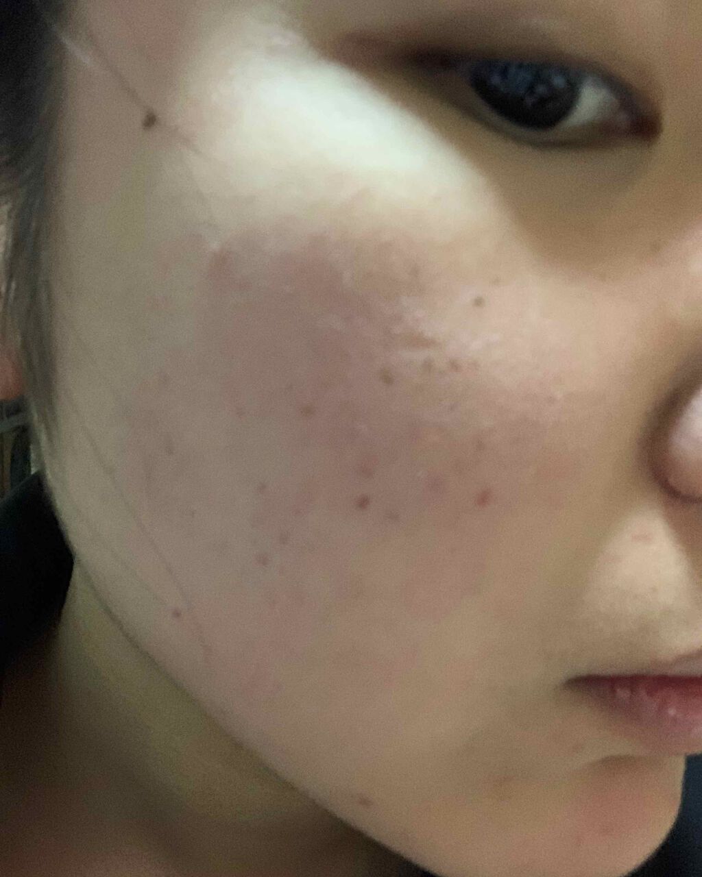 ソープD/NOV/洗顔石鹸を使ったクチコミ(3枚目)