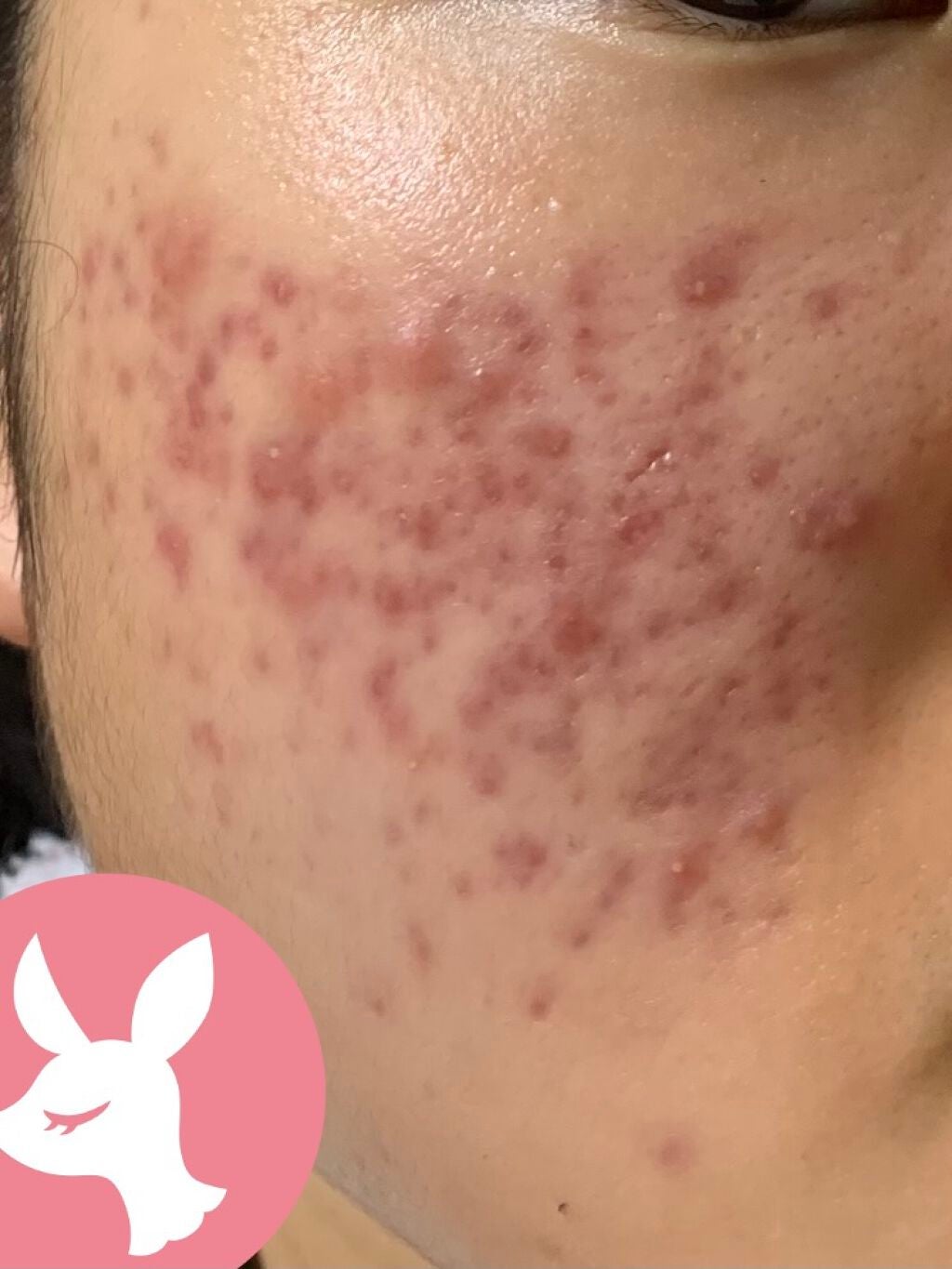 薬用ふわふわな泡洗顔/メンソレータム アクネス/泡洗顔を使ったクチコミ(2枚目)