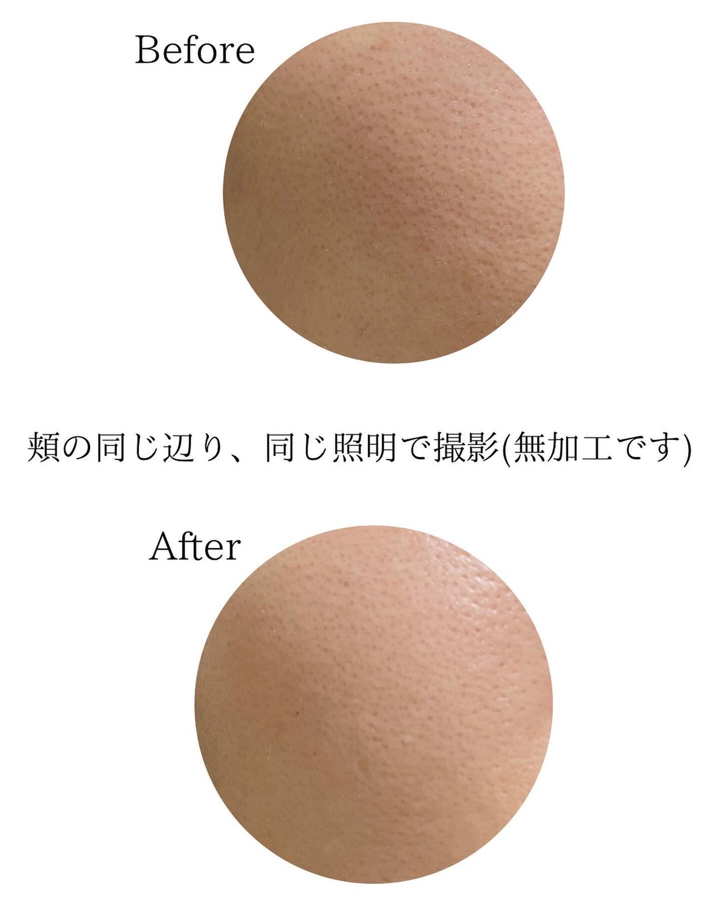 リードルショット700/VT/美容液を使ったクチコミ(7枚目)