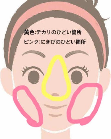 DHC 薬用 アクネケア コンシーラーのクチコミ「初投稿✨

脂性&にきび肌の私のベースメイク💆🏻‍♀️

〜前置き〜
私はセザンヌの皮脂防止下.....」（2枚目）