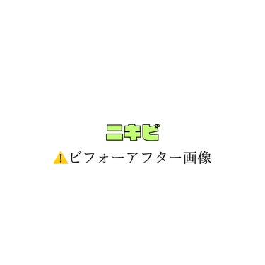 ichi on LIPS 「ニキビでずっと悩んできていて自分で試したり勉強したりして出来づ..」（1枚目）