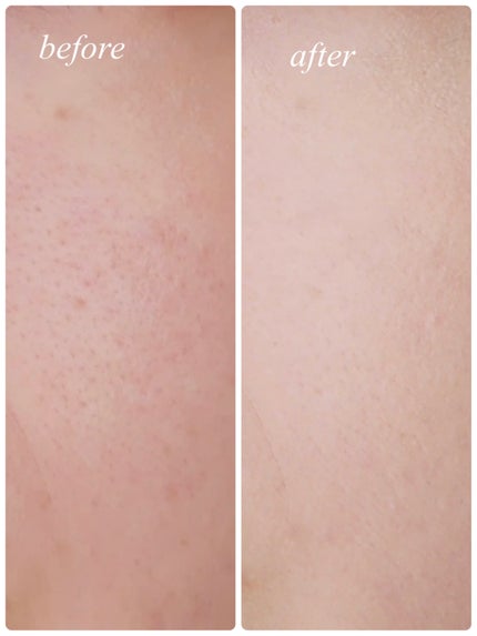 フィー クッションエッグフィットカバー/fwee/クッションファンデーションを使ったクチコミ(5枚目)